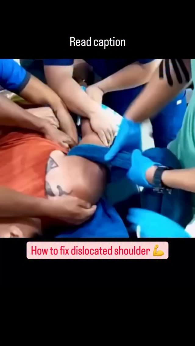 dislocated shoulder occurs when the upper arm bone (humerus) pops out of the shoulder socket, causin…