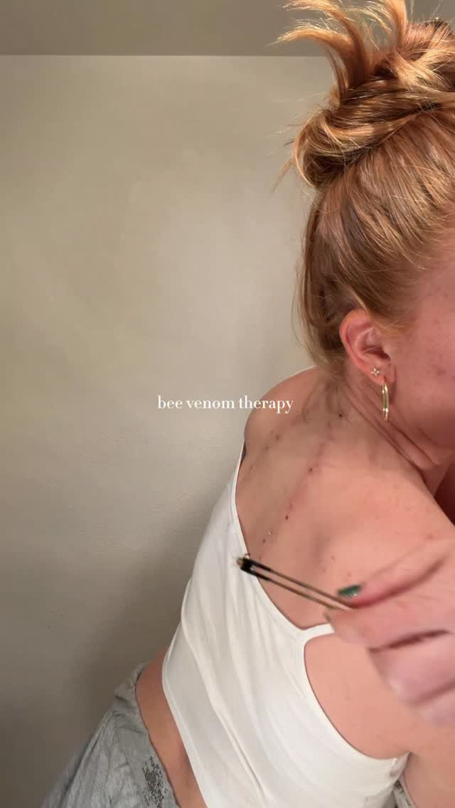 When I first started bee venom therapy, I knew I would be stinging myself with bees. What I don’t kn…