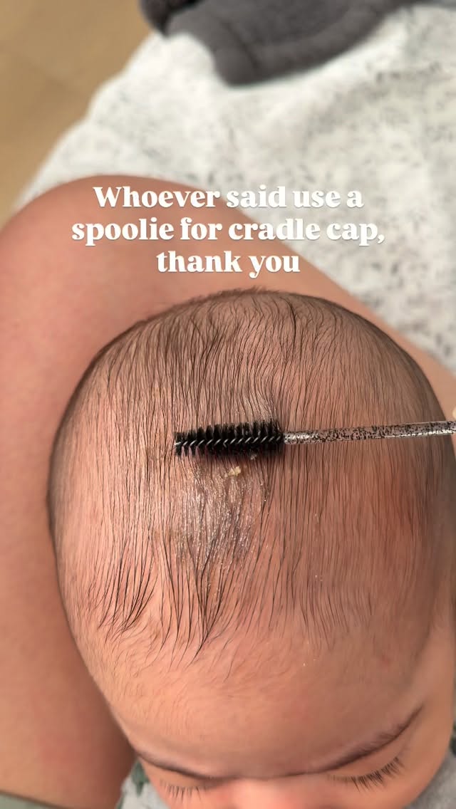 Post bath, with a head lathered in coconut oil 🤝 Note: I’m not scrubbing it off, just gently picking…