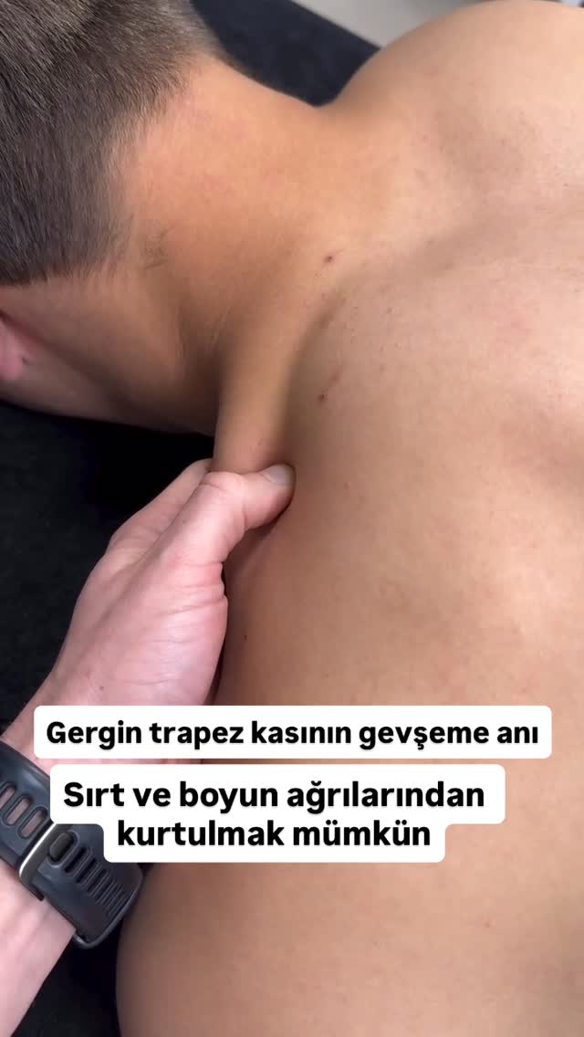 Gergin trapez kasını gevşeterek onun sebep olduğu ağrılardan kurtulabilirsiniz. ⭕️Baş ağrısı ⭕️Migre…