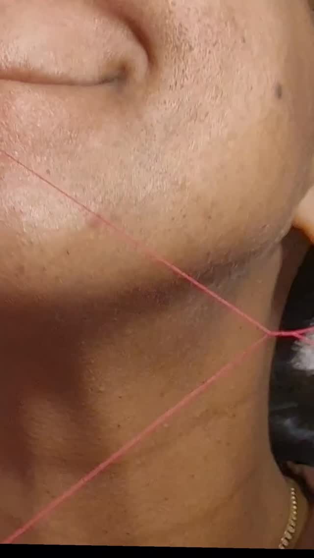 3 tiny hairs #hairy #threading #pcos #threadinghairremoval #satisfying #beautycare #beauty #beforean…