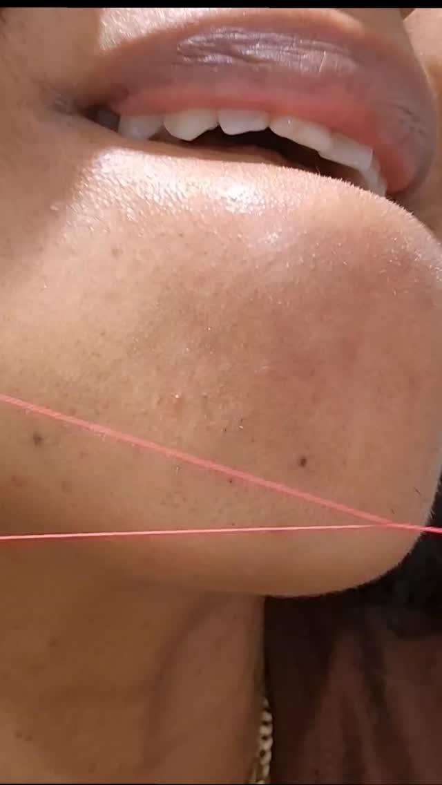 Fine hair removal technique #threading #pcos #asmr #beauty #beautyroutine
