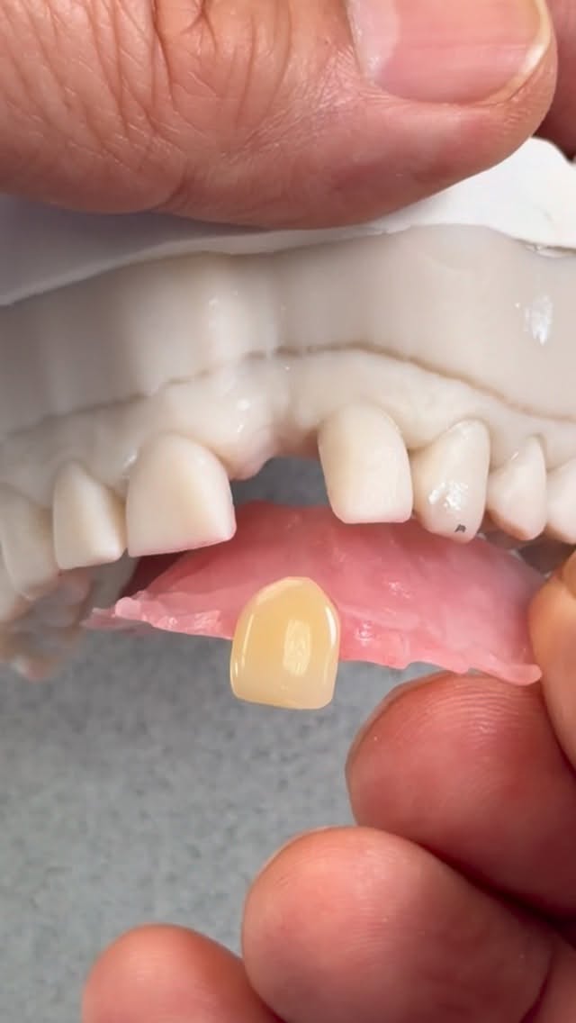 Flipper that we just completed in my lab for Dr. Shelby Roney in South Dakota