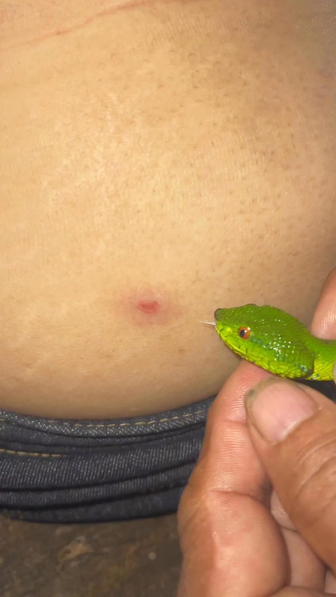 Miracle Snake Bite 🐍💉💊🇵🇭 Right to Indigenous Knowledge Systems and to Develop own Sciences and Techn…
