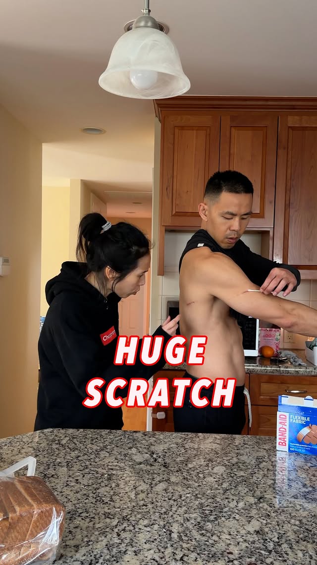 Huge scratch #couplegoals