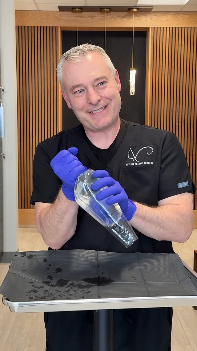 pushing a 500cc silicone implant through a Keller funnel.. harder than it looks. (And Esther made th…
