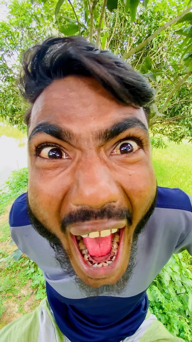 গ্রামের ২G নেট 🤣😂