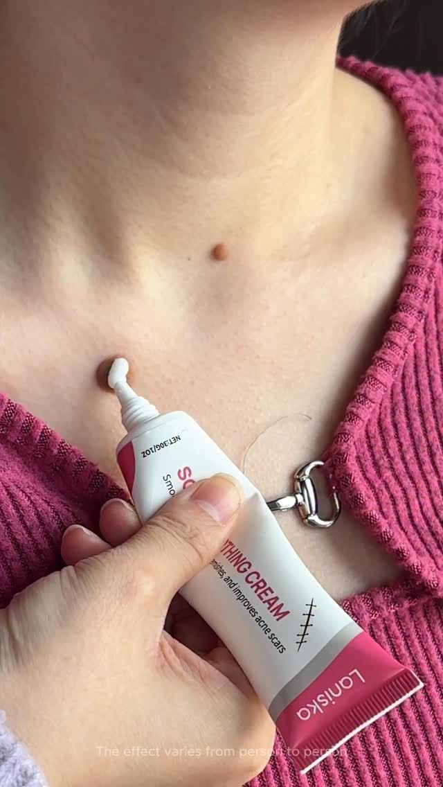 Wart removel cream #wart #skincare #skincareroutine #makeupartist