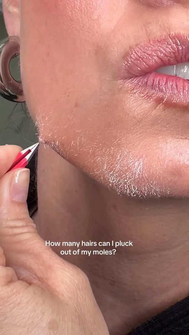 I lost count at 6! 🙃 how many do you see? Also, the reason I pluck my mole hairs is because they are…