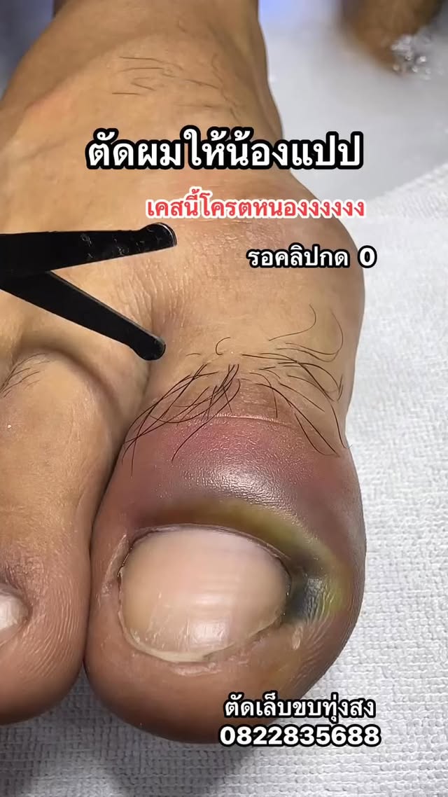 ตัดผมให้น้องสักหน่อยก่อนตัดเล็บ